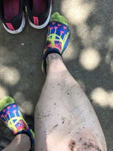 my leg